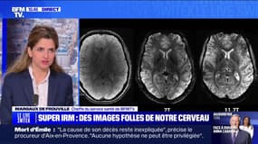 L'IRM "le plus puissant du monde" dévoile des images folles de notre cerveau