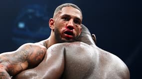 Tony Yoka le nez en sang lors de son combat contre Martin Bakole en mai 2022