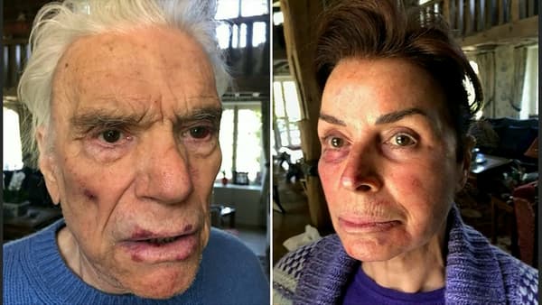 Bernard and Dominique Tapie after being assaulted during a burglary at their home, Sunday April 4, 2021