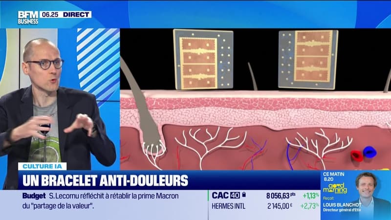 Culture IA : Un bracelet anti-douleurs, par Anthony Morel - 03/10