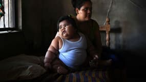 Luisito âgé de 10 mois pèse 28 kilos, un cas  spectaculaire d'obésité et de diabète infantile au Mexique