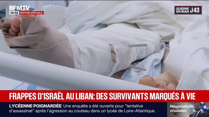 "La douleur est insupportable": ces survivants marqués à vie par les frappes d'Israël au Liban