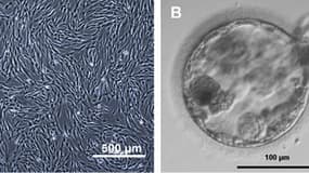 Images provenant de l'article sur la première création de cellules souches embryonnaires humaines par clonage.