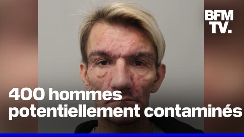 Des centaines d'hommes potentiellement contaminés au VIH par un 
