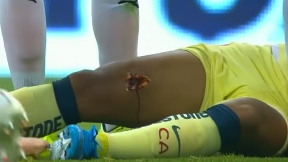 La blessure de Dos Santos
