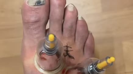 Le pied de Karim Benzema.