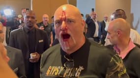 Le père de Tyson Fury la tête en sang après s'être battu avec la team Usyk, le 13 mai 2024
