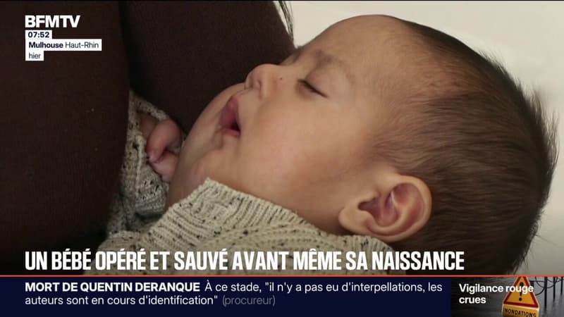 Ce bébé a été sauvé d'une tumeur grâce à un traitement prénatal