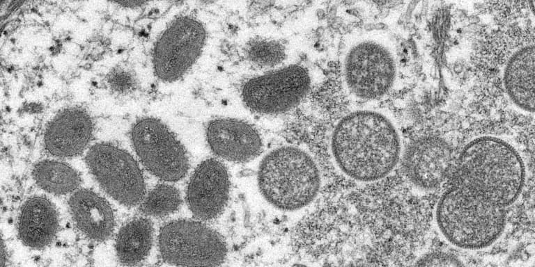 Image issue d'un microscope électronique montrant un virion de variole du singe, obtenu d'un échantillon issu de l'épidémie chez des chiens de prairie en 2003