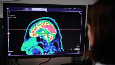 Image d'illustration - Scanner du cerveau