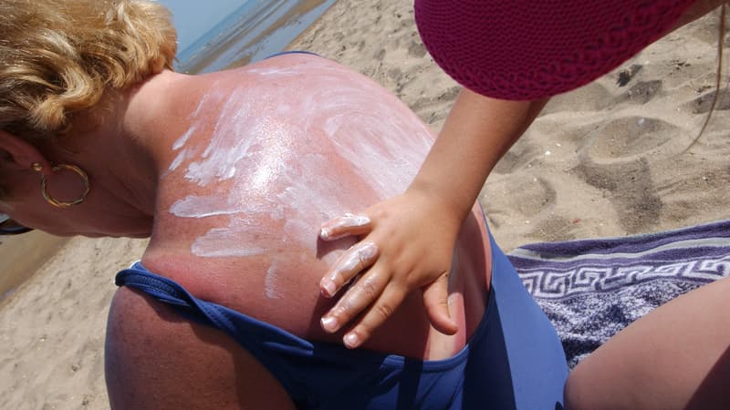 Les Pays-Bas fournissent de la crème solaire gratuite pour lutter contre les cancers de la peau