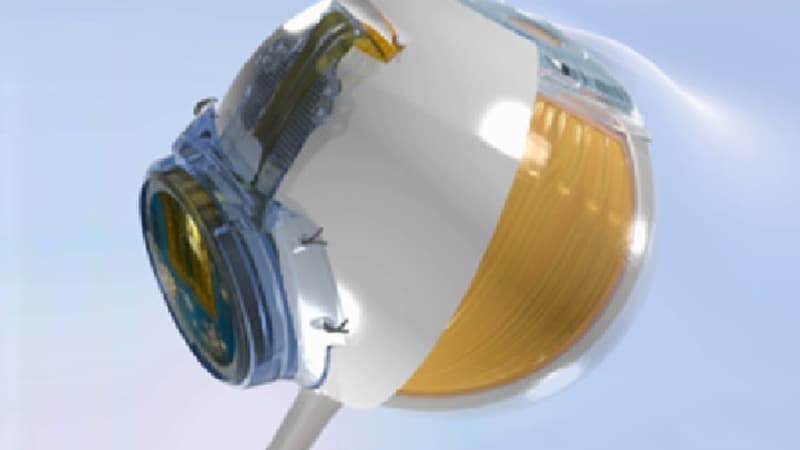 Trois ans de port, aucune défaillance pour l'implant rétinien de Pixium Vision