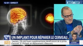 Un implant pour réparer le cerveau