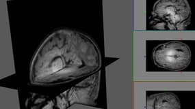 Coupes du cerveau humain obtenues par résonnance magnétique (IRM) - illustration.
