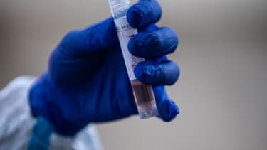 Les échantillons prélevés sur les patients ont été faits à partir de tests PCR.