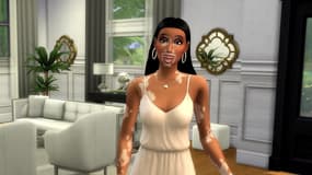 Le Vitiligo, maladie de peau, fait son apparition dans les Sims 4