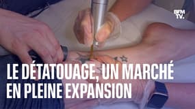 Le détatouage, un marché en pleine expansion