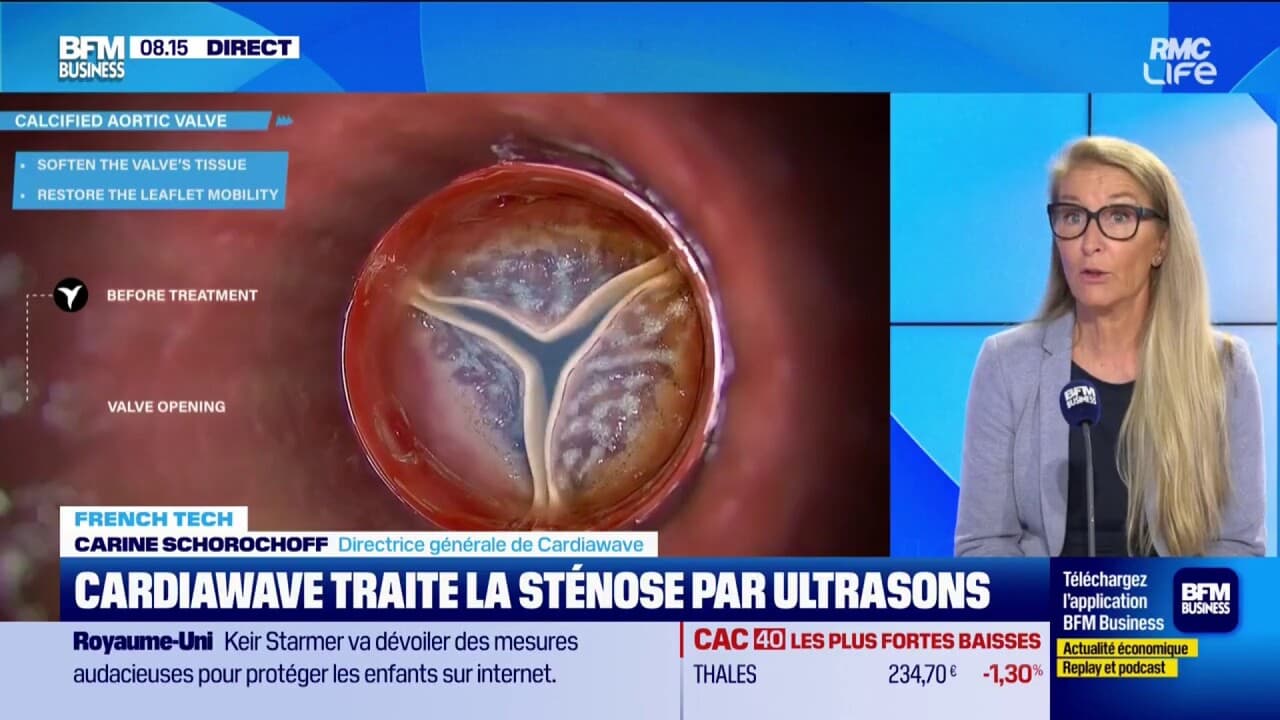 Cardiawave darlığı ultrasonla tedavi ediyor