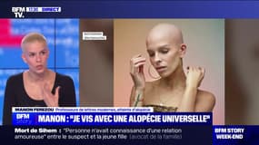 "On a l'impression de n'avoir aucune maîtrise sur ce qui nous arrive": atteinte d’alopécie, Manon Ferezou témoigne