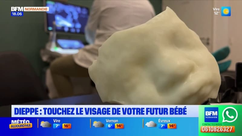 Dieppe: touchez le visage de votre futur bébé