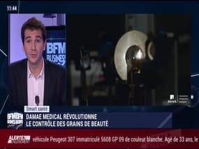 Smart Santé: Damae Medical révolutionne le contrôle des grains de beauté - 06/01