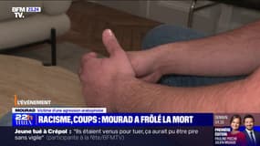 "Je me voyais partir": Le témoignage de Mourad, jardinier de 29 ans, victime d'un coup de cutter à la gorge au cours d'une agression raciste à Villecresnes (Val-de-Marne)
