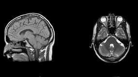 Une IRM montrant un cerveau humain (photo d'illustration).