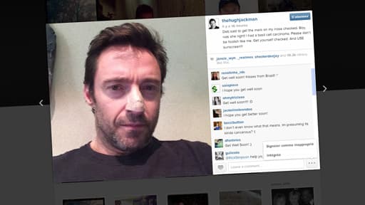 Dans le commentaire de sa photo, Hugh Jackman explique qu'il s'est fait retirer un carcinome.