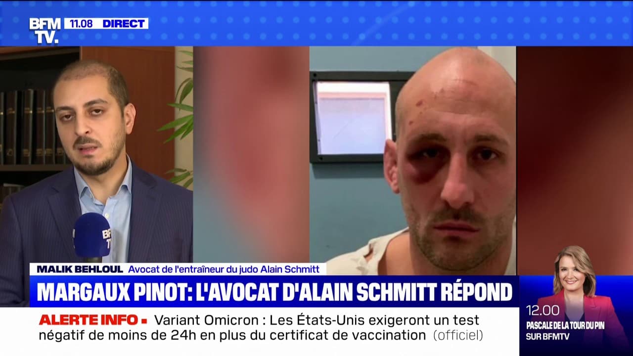 Le visage tuméfié d'Alain Schmitt Le visage tuméfié d'Alain Schmitt