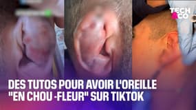 Des utilisateurs partagent des tutos pour avoir une oreille "en chou-fleur" sur Tiktok