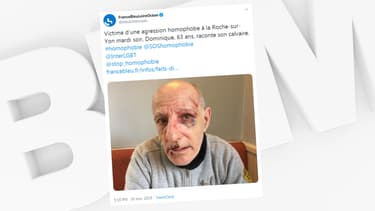 Le sexagénaire agressé à La-Roche-sur-Yon.