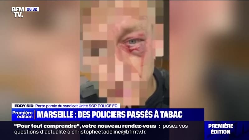 Marseille: deux policiers ont été frappés par des dealers lors d'une interpellation