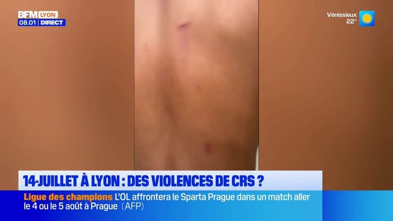 14-juillet à Lyon : des violences de CRS ?