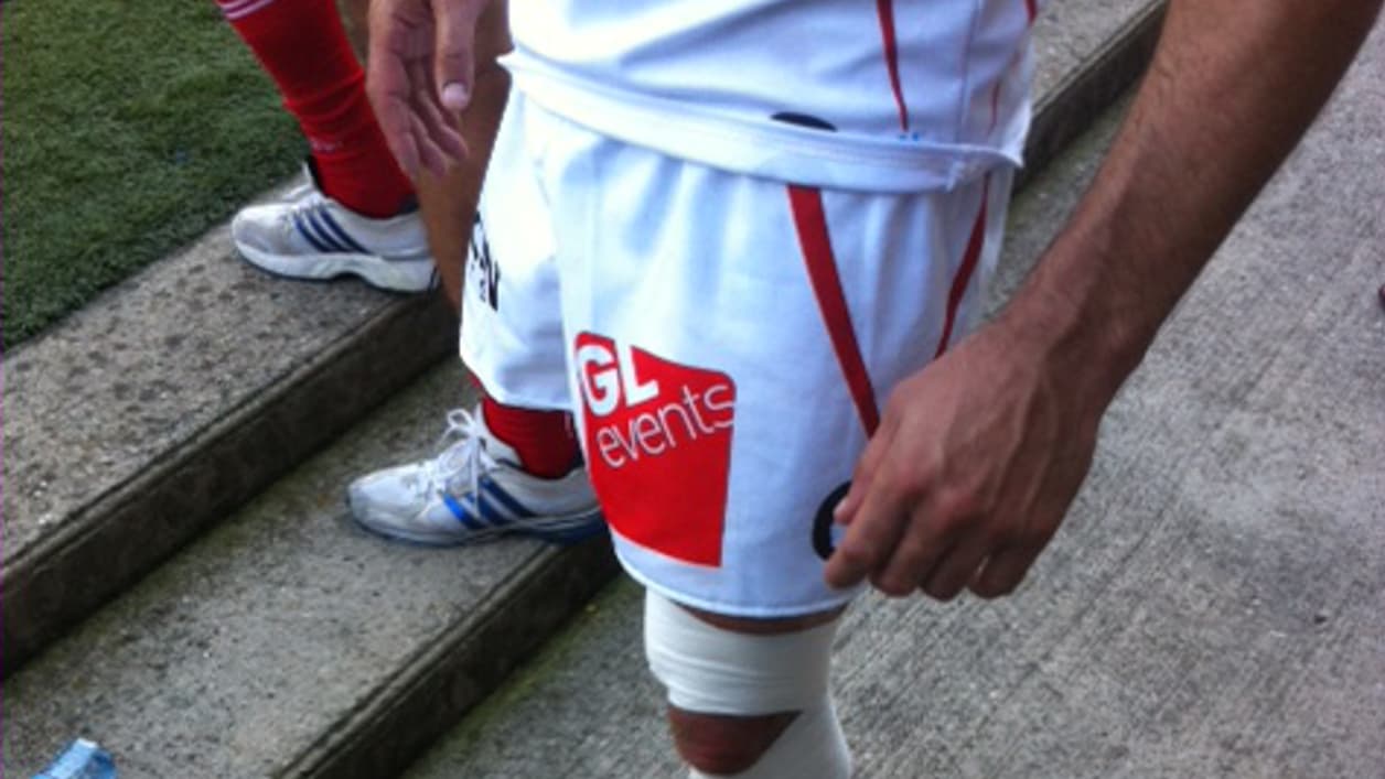 Le genou blessé de Sébastien Chabal Le genou blessé de Sébastien Chabal