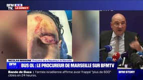 Incidents avant OM/OL: l'ITT de Fabio Grosso réévaluée à "30 jours", rapporte le procureur de Marseille 