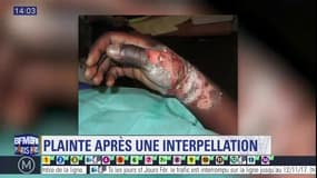 Mantes-la-Jolie : un homme gravement brûlé porte plainte pour "violences policières à caractère raciste" 