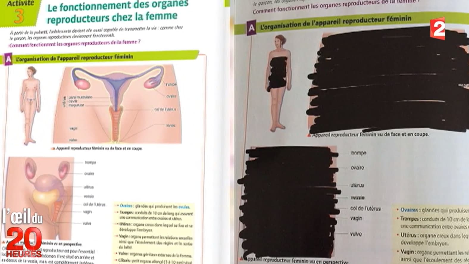 Les organes reproducteurs féminins complétement raturés. Les organes reproducteurs féminins complétement raturés.