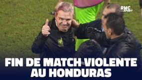 Concacaf : Le sélectionneur mexicain termine en sang après un jet de canette