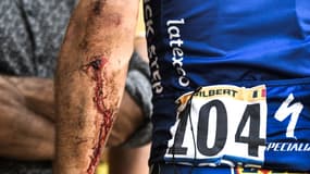 Le bras de Philippe Gilbert après sa chute