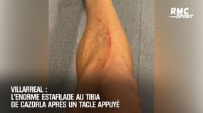 Villarreal: L'énorme entaille de Cazorla après un tacle appuyé