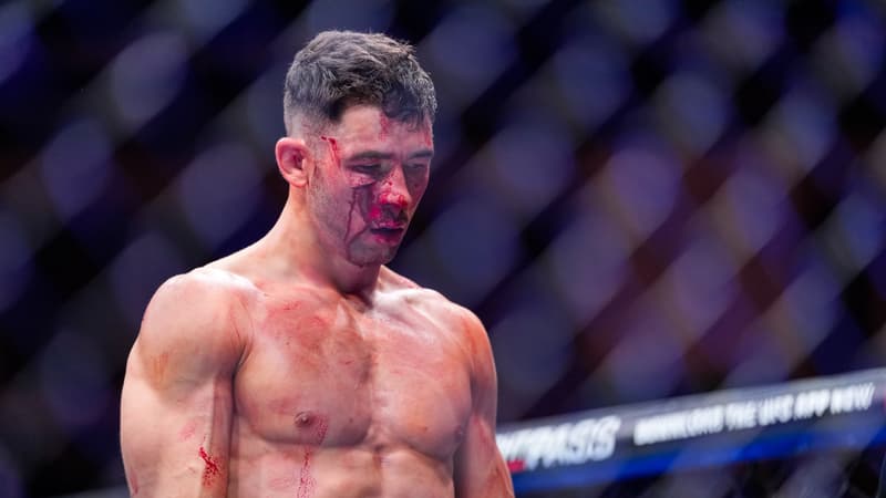 UFC Londres: lèvres en sang, pommette ouverte… les impressionnantes blessures au visage d’Axel Sola, qui décroche un bonus malgré sa défaite