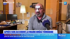 "Je m'en tire bien": le maire normand gravement brûlé en rallumant la chaudière à bois de sa commune témoigne