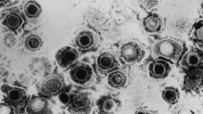 Le virus herpès simplex.