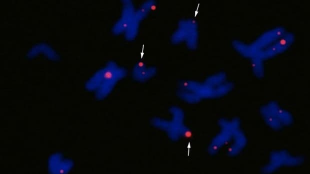 Les quadruples hélices (en rouge) visibles dans les chromosomes humains (en bleu).