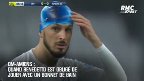 OM-Amiens: Quand Benedetto est obligé de jouer avec un bonnet de bain !
