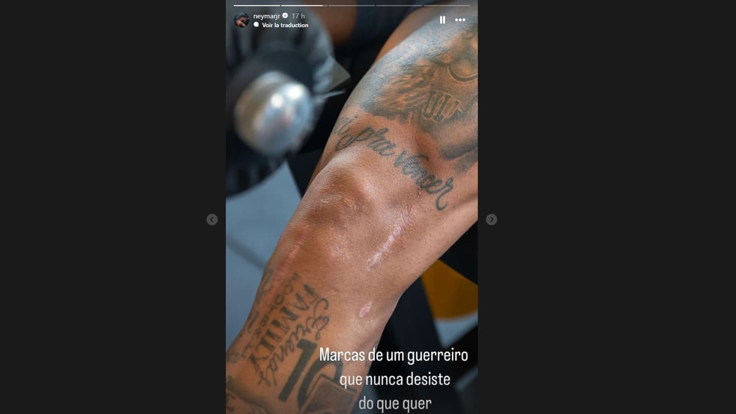 "Les marques d'un guerrier qui n'abandonne jamais", la story Instagram de Neymar un an après sa grave blessure au genou gauche, le 17 octobre 2024 "Les marques d'un guerrier qui n'abandonne jamais", la story Instagram de Neymar un an après sa grave blessure au genou gauche, le 17 octobre 2024