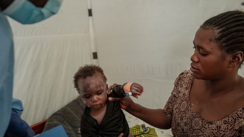 Un enfant aidé par sa mère sous le regard d'un agent de santé au centre de traitement du Mpox à l'hôpital général de référence de Nyiragongo, au nord de Goma, le 17 août 2024. 