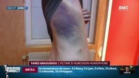 "On fait rien de mal, on s'aime", Farès témoigne après son agression homophobe à Lille