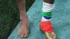La cheville de Neymar - Brésil-Serbie - Coupe du monde 2022