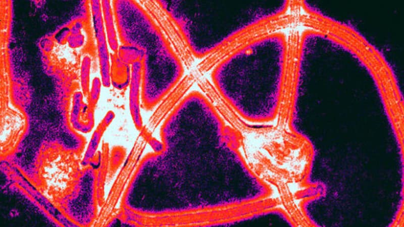 La réapparition de l'épidémie d'Ebola au Liberia est la conséquence de la résurgence du virus chez un individu précédemment infecté. (Photo d'illustration)